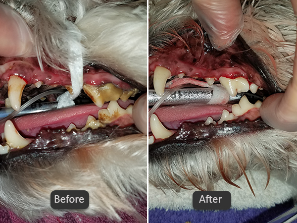Before and After Dental Cleaning
